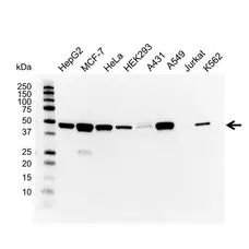 Anti Cytokeratin 18/19 Antibody, clone AbD03748 (PrecisionAb Monoclonal Antibody) gallery image 1