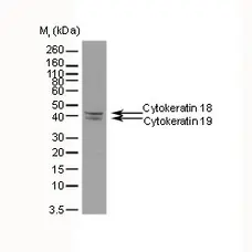 Anti Cytokeratin 18/19 Antibody, clone AbD03748 (PrecisionAb Monoclonal Antibody) gallery image 2