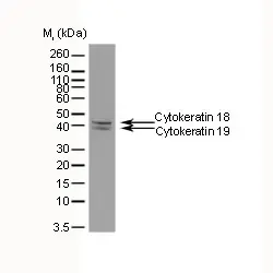 Anti Cytokeratin 18/19 Antibody, clone AbD03748 (PrecisionAb Monoclonal Antibody) gallery image 2