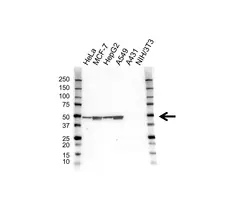 Anti Cytokeratin 18 Antibody, clone AbD25791 (PrecisionAb Monoclonal Antibody) gallery image 1