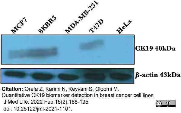 Anti Human Cytokeratin 19 Antibody, clone A53-B/A2 (Monoclonal Antibody Antibody) gallery image 7