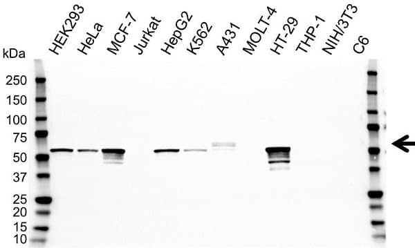 Anti Cytokeratin 5 Antibody (PrecisionAb Monoclonal Antibody) gallery image 1