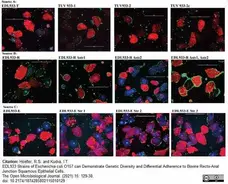 Anti Human Cytokeratin (Pan Reactive) Antibody, clone C-11 gallery image 1