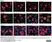 Anti Human Cytokeratin (Pan Reactive) Antibody, clone C-11 thumbnail image 1