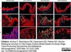 Anti Human Cytokeratin (Pan Reactive) Antibody, clone C-11 gallery image 2