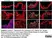 Anti Human Cytokeratin (Pan Reactive) Antibody, clone C-11 thumbnail image 2