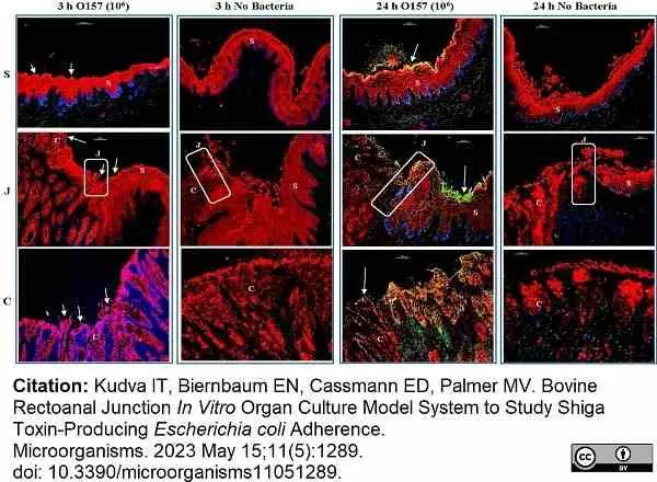 Anti Human Cytokeratin (Pan Reactive) Antibody, clone C-11 gallery image 2