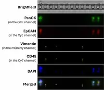 Anti Human Cytokeratin (Pan Reactive) Antibody, clone C-11 gallery image 6