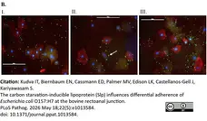 Anti Human Cytokeratin (Pan Reactive) Antibody, clone C-11 gallery image 7