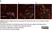 Anti Human Cytokeratin (Pan Reactive) Antibody, clone C-11 thumbnail image 7