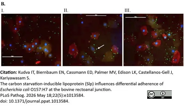 Anti Human Cytokeratin (Pan Reactive) Antibody, clone C-11 gallery image 7