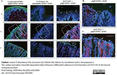 Anti Human Cytokeratin (Pan Reactive) Antibody, clone C-11 gallery image 9