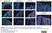 Anti Human Cytokeratin (Pan Reactive) Antibody, clone C-11 thumbnail image 9
