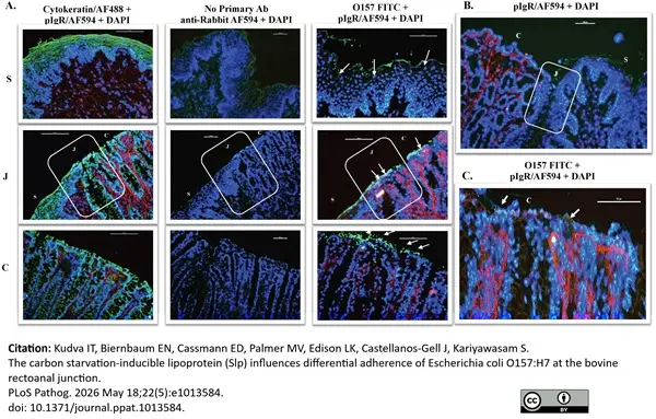 Anti Human Cytokeratin (Pan Reactive) Antibody, clone C-11 gallery image 9
