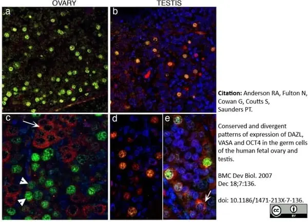 Anti DAZL Antibody, clone 3/11A gallery image 10