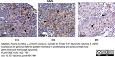 Anti DAZL Antibody, clone 3/11A gallery image 11