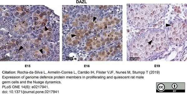 Anti DAZL Antibody, clone 3/11A gallery image 11