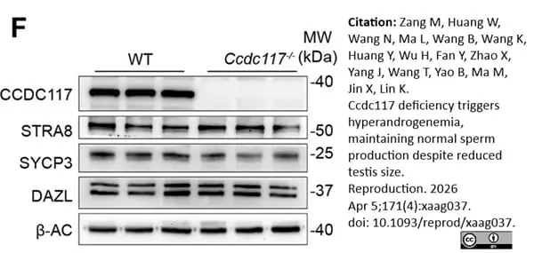 Anti DAZL Antibody, clone 3/11A gallery image 13