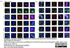 Anti DAZL Antibody, clone 3/11A gallery image 6