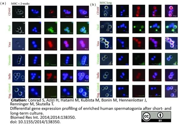Anti DAZL Antibody, clone 3/11A gallery image 6