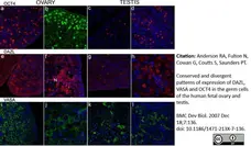 Anti DAZL Antibody, clone 3/11A gallery image 9
