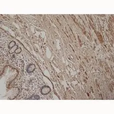 Anti Human Desmin Antibody, clone AbD03744 gallery image 1