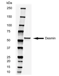 Anti Human Desmin Antibody, clone AbD03744 gallery image 2
