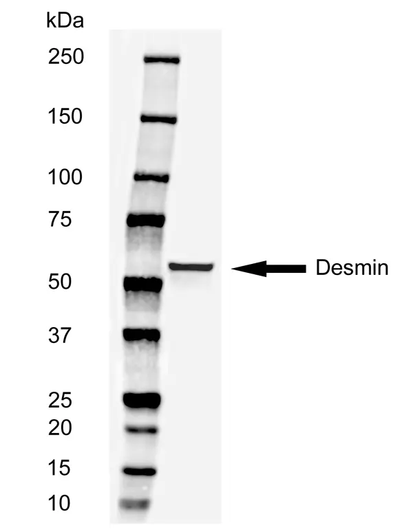 Anti Human Desmin Antibody, clone AbD03744 gallery image 2
