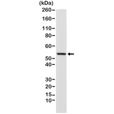 Anti Desmin Antibody, clone RM234 gallery image 1