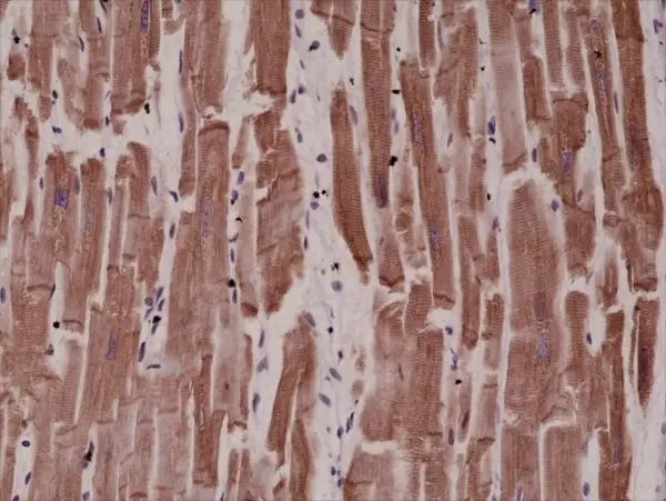 Anti Desmin Antibody, clone RM234 gallery image 2