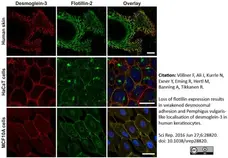 Anti Human Desmoglein 3 Antibody, clone 5G11 gallery image 1