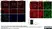 Anti Human Desmoglein 3 Antibody, clone 5G11 thumbnail image 2