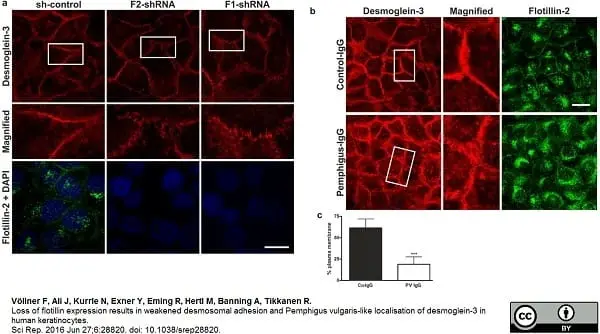 Anti Human Desmoglein 3 Antibody, clone 5G11 gallery image 2