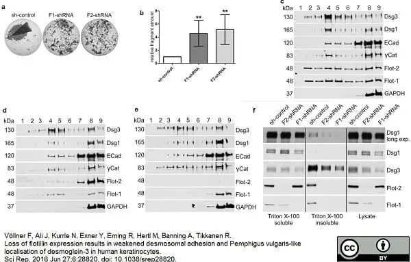 Anti Human Desmoglein 3 Antibody, clone 5G11 gallery image 4