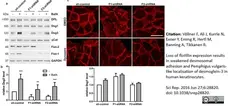 Anti Human Desmoglein 3 Antibody, clone 5G11 gallery image 5