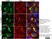 Anti Human Desmoglein 3 Antibody, clone 5G11 thumbnail image 6