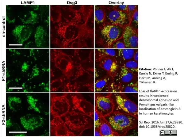 Anti Human Desmoglein 3 Antibody, clone 5G11 gallery image 6