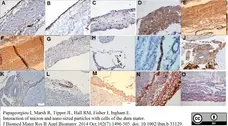 Anti Desmoplakin 1/2 Antibody, clone DP-2.15 gallery image 2