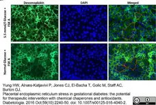 Anti Desmoplakin 1/2 Antibody, clone DP-2.15 gallery image 3