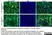 Anti Desmoplakin 1/2 Antibody, clone DP-2.15 thumbnail image 3
