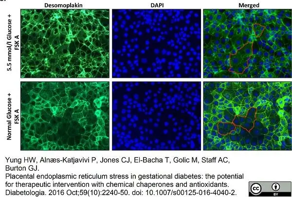 Anti Desmoplakin 1/2 Antibody, clone DP-2.15 gallery image 3