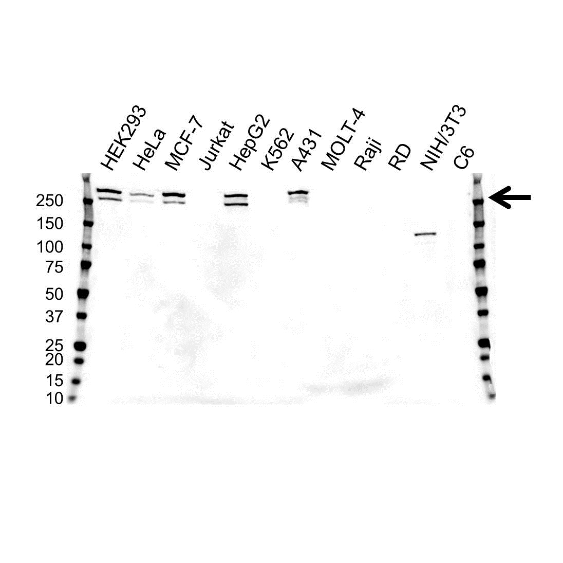 Anti Desmoplakin Antibody (PrecisionAb Monoclonal Antibody) gallery image 1