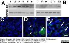 Anti Human DJ-1 (Oxidized at C106) Antibody, clone AbD03055 gallery image 3