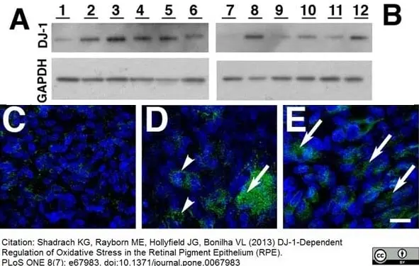 Anti Human DJ-1 (Oxidized at C106) Antibody, clone AbD03055 gallery image 3