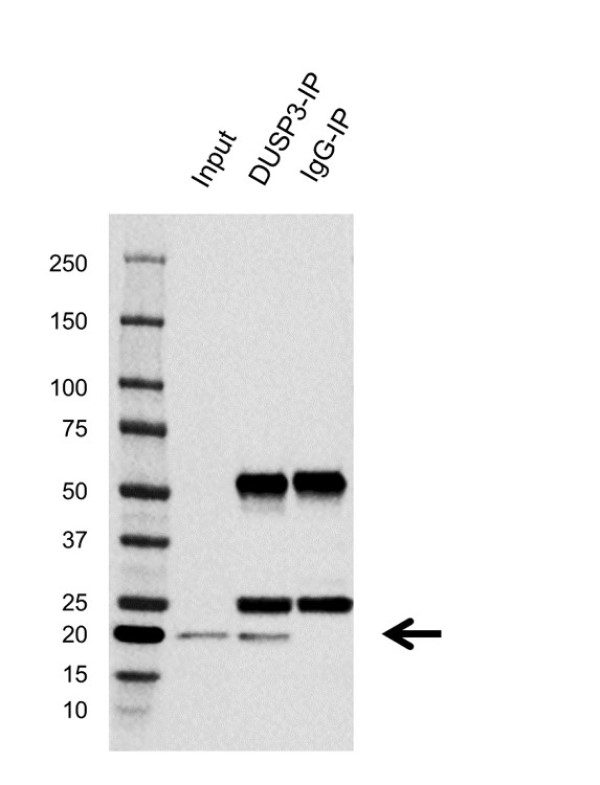 Anti Human DUSP3 Antibody, clone E02/5H5 (PrecisionAb Monoclonal Antibody) gallery image 2