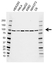 Anti EEF2 Antibody, clone AB02/1A11 (PrecisionAb Monoclonal Antibody) thumbnail image 1