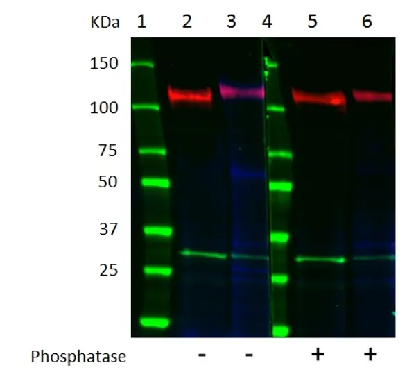 Anti EGF Receptor Antibody, clone G02-2D5 (PrecisionAb Monoclonal Antibody) gallery image 2