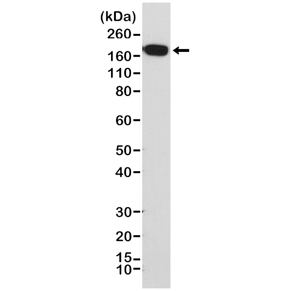 Anti EGF Receptor Antibody, clone RM294 gallery image 1