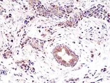 Anti EGF Receptor Antibody, clone RM294 gallery image 2