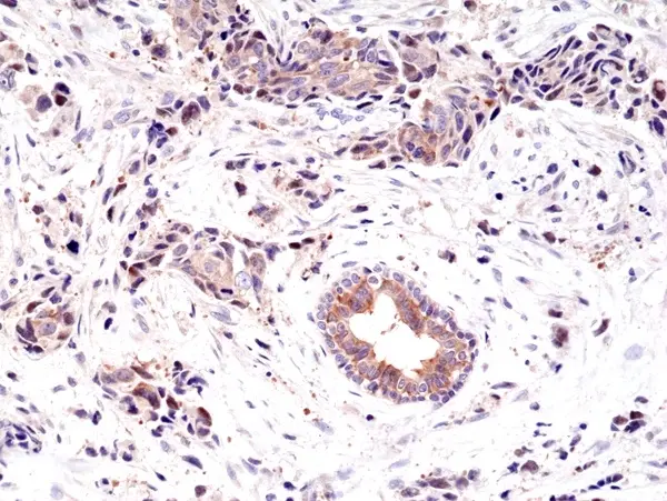 Anti EGF Receptor Antibody, clone RM294 gallery image 2